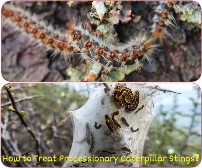 How to treat processionnary caterpillards stings