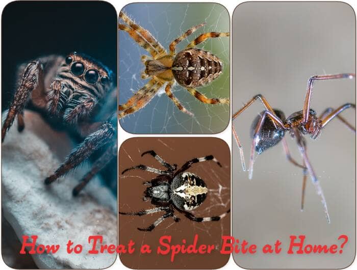 how to treat a spider bite at home